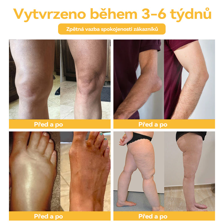 🌏𝐎𝐲𝐢𝐤𝐞𝐲™ krém na artritídu s včelím jedom a kurkumou🐝 (ideálny pre starších ľudí a odporúčaný Slovenskou ortopedickou spoločnosťou SOTS).