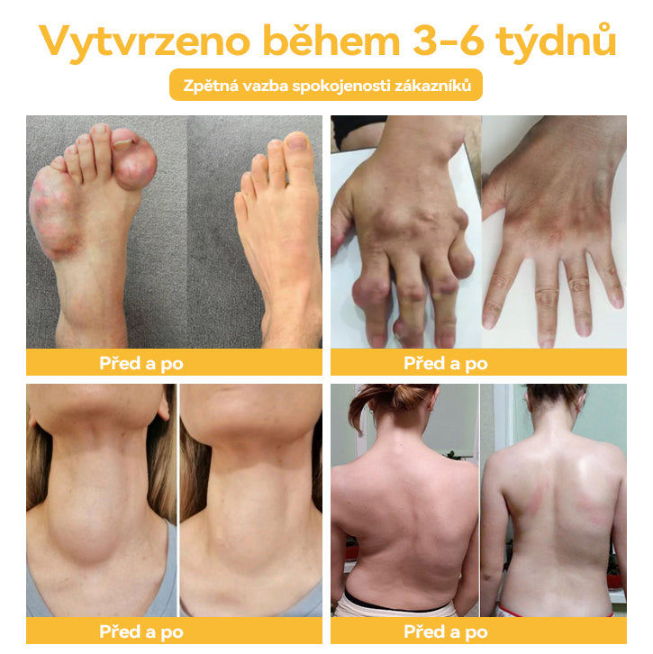 🌏𝐎𝐲𝐢𝐤𝐞𝐲™ krém na artritídu s včelím jedom a kurkumou🐝 (ideálny pre starších ľudí a odporúčaný Slovenskou ortopedickou spoločnosťou SOTS).