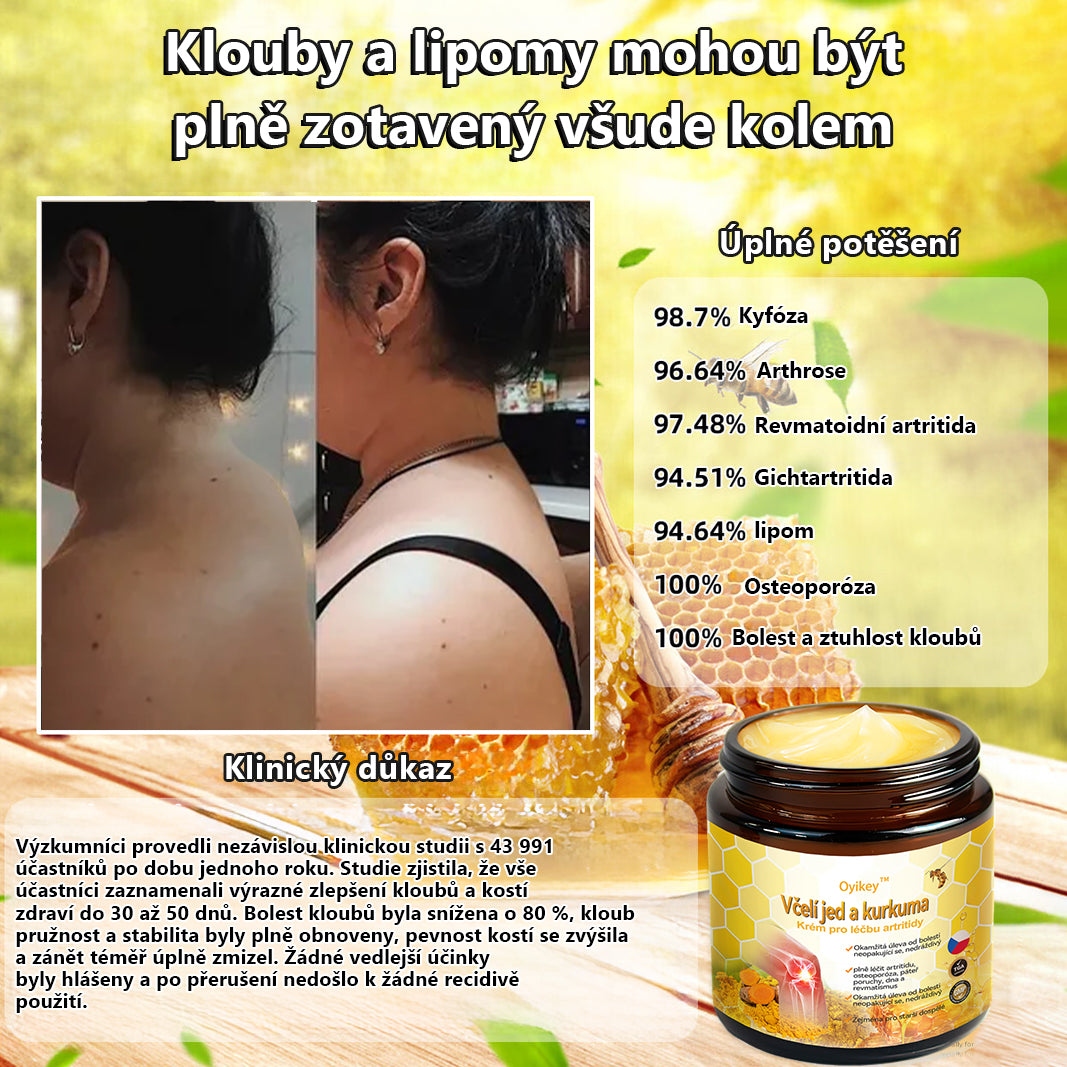 🌏𝐎𝐲𝐢𝐤𝐞𝐲™ krém na artritídu s včelím jedom a kurkumou🐝 (ideálny pre starších ľudí a odporúčaný Slovenskou ortopedickou spoločnosťou SOTS).