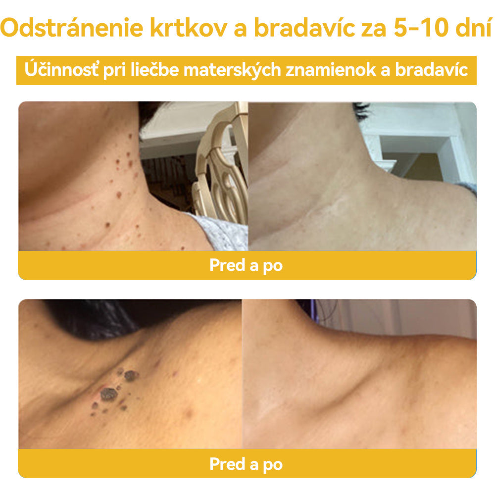 🍓𝑺𝒑𝒛𝒗™ 𝑽č𝒆𝒍í 𝒋𝒆𝒅 𝑲𝒓é𝒎 𝒏𝒂 𝒐š𝒆𝒕𝒓𝒆𝒏𝒊𝒆 𝒌𝒓𝒕𝒌𝒐𝒗 𝒂 𝒃𝒓𝒂𝒅𝒂𝒗í𝒄⚡⚡(🧑⚕️𝑶𝒅𝒑𝒐𝒓úč𝒂𝒏𝒊𝒆 š𝒑𝒆𝒄𝒊𝒂𝒍𝒊𝒔𝒕𝒖 𝒅𝒆𝒓𝒎𝒂𝒕𝒐𝒍ó𝒈𝒂🔥🔥𝑷𝒐𝒔𝒍𝒆𝒅𝒏ý 𝒅𝒆ň 𝒑𝒓𝒐𝒑𝒂𝒈á𝒄𝒊𝒆 80% 𝒗𝒚𝒑𝒏𝒖𝒕é)