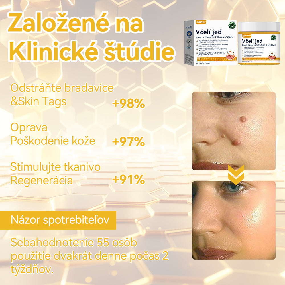 🍓𝑺𝒑𝒛𝒗™ 𝑽č𝒆𝒍í 𝒋𝒆𝒅 𝑲𝒓é𝒎 𝒏𝒂 𝒐š𝒆𝒕𝒓𝒆𝒏𝒊𝒆 𝒌𝒓𝒕𝒌𝒐𝒗 𝒂 𝒃𝒓𝒂𝒅𝒂𝒗í𝒄⚡⚡(🧑⚕️𝑶𝒅𝒑𝒐𝒓úč𝒂𝒏𝒊𝒆 š𝒑𝒆𝒄𝒊𝒂𝒍𝒊𝒔𝒕𝒖 𝒅𝒆𝒓𝒎𝒂𝒕𝒐𝒍ó𝒈𝒂🔥🔥𝑷𝒐𝒔𝒍𝒆𝒅𝒏ý 𝒅𝒆ň 𝒑𝒓𝒐𝒑𝒂𝒈á𝒄𝒊𝒆 80% 𝒗𝒚𝒑𝒏𝒖𝒕é)