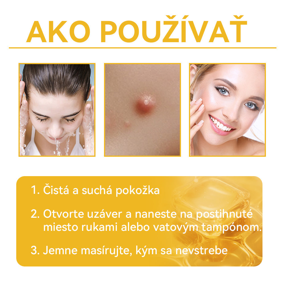 🍓𝑺𝒑𝒛𝒗™ 𝑽č𝒆𝒍í 𝒋𝒆𝒅 𝑲𝒓é𝒎 𝒏𝒂 𝒐š𝒆𝒕𝒓𝒆𝒏𝒊𝒆 𝒌𝒓𝒕𝒌𝒐𝒗 𝒂 𝒃𝒓𝒂𝒅𝒂𝒗í𝒄⚡⚡(🧑⚕️𝑶𝒅𝒑𝒐𝒓úč𝒂𝒏𝒊𝒆 š𝒑𝒆𝒄𝒊𝒂𝒍𝒊𝒔𝒕𝒖 𝒅𝒆𝒓𝒎𝒂𝒕𝒐𝒍ó𝒈𝒂🔥🔥𝑷𝒐𝒔𝒍𝒆𝒅𝒏ý 𝒅𝒆ň 𝒑𝒓𝒐𝒑𝒂𝒈á𝒄𝒊𝒆 80% 𝒗𝒚𝒑𝒏𝒖𝒕é)