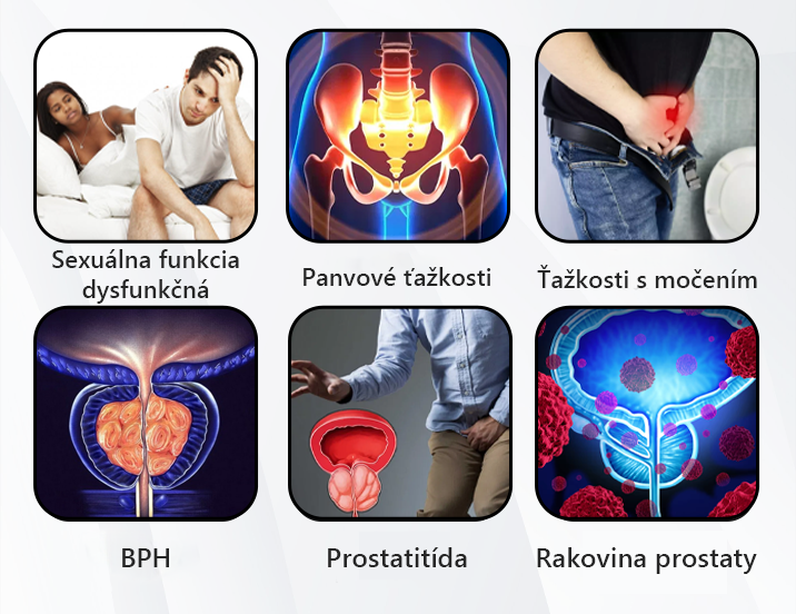 Rozlúčte sa s nepohodlím prostaty🍀𝐂𝐙𝐓𝐈𝐂𝐋𝐄™ 𝐏𝐫𝐨𝐬𝐭𝐚𝐏𝐨𝐰𝐞𝐫 𝐁𝐞𝐞 𝐢𝐧𝐡𝐚𝐥𝐚č𝐧á 𝐭𝐲č𝐢𝐧𝐤𝐚🍀(Rýchlo pôsobiace a dlhotrvajúce)