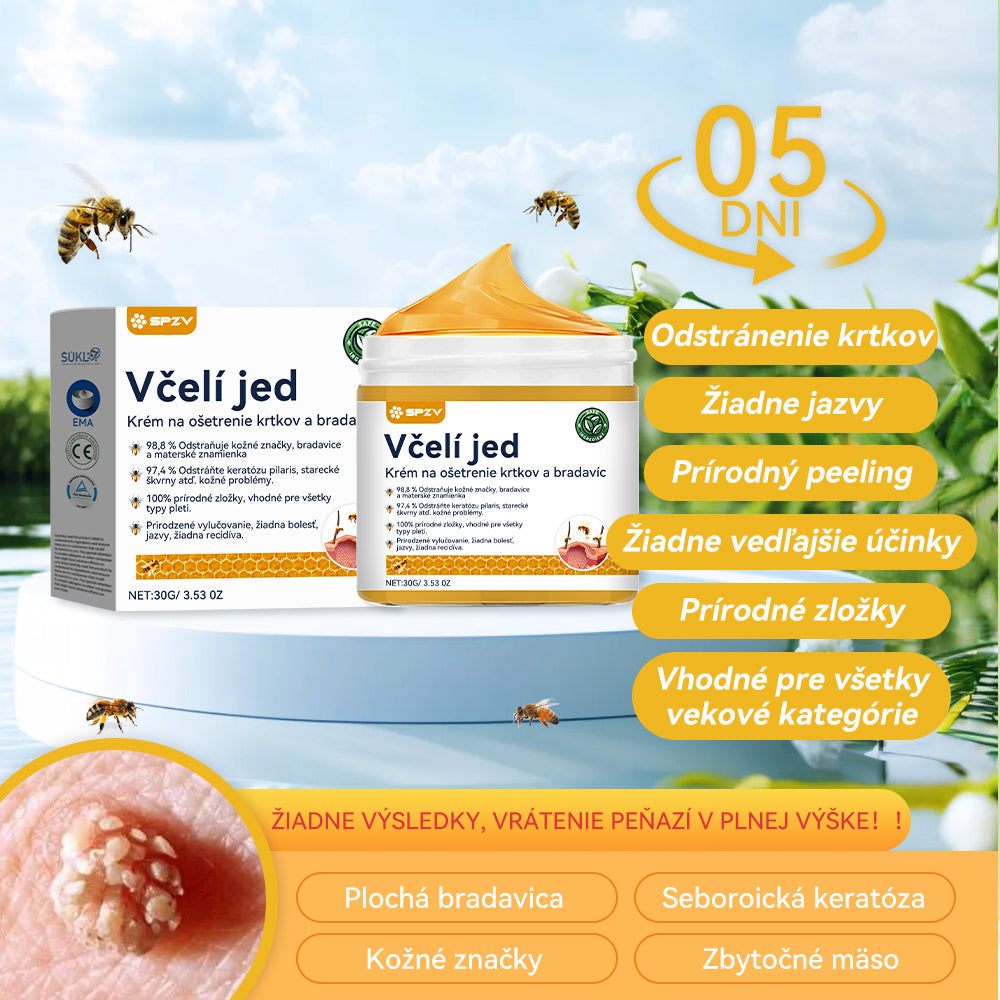 🍓𝑺𝒑𝒛𝒗™ 𝑽č𝒆𝒍í 𝒋𝒆𝒅 𝑲𝒓é𝒎 𝒏𝒂 𝒐š𝒆𝒕𝒓𝒆𝒏𝒊𝒆 𝒌𝒓𝒕𝒌𝒐𝒗 𝒂 𝒃𝒓𝒂𝒅𝒂𝒗í𝒄⚡⚡(🧑⚕️𝑶𝒅𝒑𝒐𝒓úč𝒂𝒏𝒊𝒆 š𝒑𝒆𝒄𝒊𝒂𝒍𝒊𝒔𝒕𝒖 𝒅𝒆𝒓𝒎𝒂𝒕𝒐𝒍ó𝒈𝒂🔥🔥𝑷𝒐𝒔𝒍𝒆𝒅𝒏ý 𝒅𝒆ň 𝒑𝒓𝒐𝒑𝒂𝒈á𝒄𝒊𝒆 80% 𝒗𝒚𝒑𝒏𝒖𝒕é)