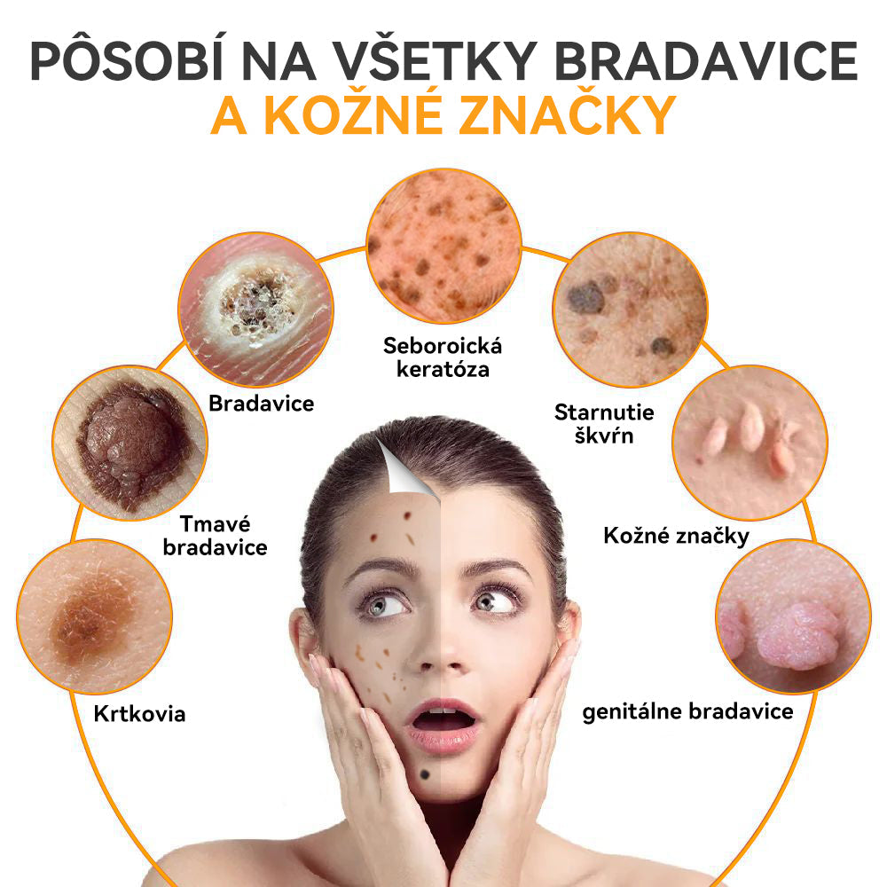 🍓𝑺𝒑𝒛𝒗™ 𝑽č𝒆𝒍í 𝒋𝒆𝒅 𝑲𝒓é𝒎 𝒏𝒂 𝒐š𝒆𝒕𝒓𝒆𝒏𝒊𝒆 𝒌𝒓𝒕𝒌𝒐𝒗 𝒂 𝒃𝒓𝒂𝒅𝒂𝒗í𝒄⚡⚡(🧑⚕️𝑶𝒅𝒑𝒐𝒓úč𝒂𝒏𝒊𝒆 š𝒑𝒆𝒄𝒊𝒂𝒍𝒊𝒔𝒕𝒖 𝒅𝒆𝒓𝒎𝒂𝒕𝒐𝒍ó𝒈𝒂🔥🔥𝑷𝒐𝒔𝒍𝒆𝒅𝒏ý 𝒅𝒆ň 𝒑𝒓𝒐𝒑𝒂𝒈á𝒄𝒊𝒆 80% 𝒗𝒚𝒑𝒏𝒖𝒕é)