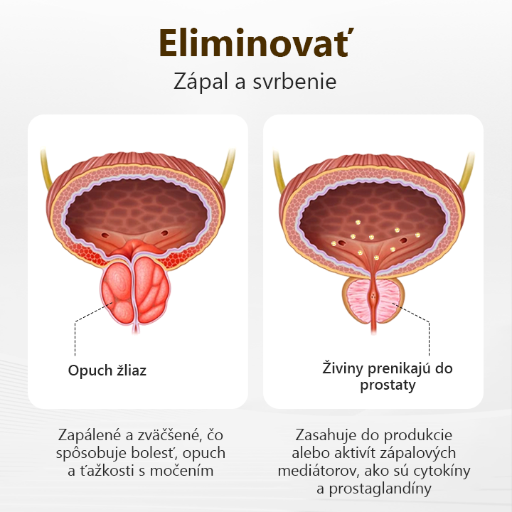 Rozlúčte sa s nepohodlím prostaty🍀𝐂𝐙𝐓𝐈𝐂𝐋𝐄™ 𝐏𝐫𝐨𝐬𝐭𝐚𝐏𝐨𝐰𝐞𝐫 𝐁𝐞𝐞 𝐢𝐧𝐡𝐚𝐥𝐚č𝐧á 𝐭𝐲č𝐢𝐧𝐤𝐚🍀(Rýchlo pôsobiace a dlhotrvajúce)