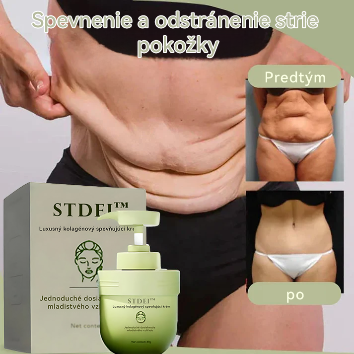 STDEI™ 💖 Luxusný kolagénový krém na pevnosť (návrat k mladistvej pleti)✨