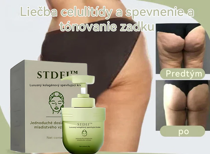 STDEI™ 💖 Luxusný kolagénový krém na pevnosť (návrat k mladistvej pleti)✨