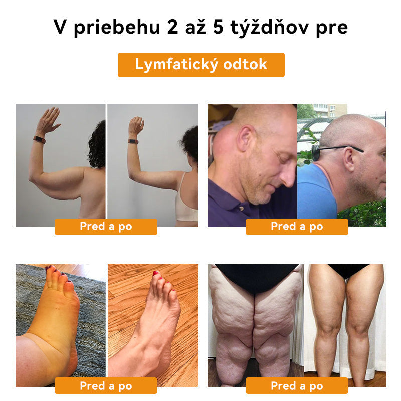 🍯𝐅𝐑𝐎𝐏𝐔𝐍™ 𝐃𝐞𝐭𝐨𝐱𝐢𝐤𝐚č𝐧á 𝐚 𝐭𝐯𝐚𝐫𝐮𝐣ú𝐜𝐚 𝐧á𝐩𝐥𝐚𝐬ť 𝐬 𝐯č𝐞𝐥í𝐦 𝐣𝐞𝐝𝐨𝐦 𝐚 𝐚𝐛𝐬𝐢𝐧𝐭𝐨𝐦🐝 (𝐯𝐡𝐨𝐝𝐧á 𝐩𝐫𝐞 𝐯š𝐞𝐭𝐤𝐲 𝐥𝐲𝐦𝐟𝐚𝐭𝐢𝐜𝐤é 𝐩𝐫𝐨𝐛𝐥é𝐦𝐲 𝐚 𝐨𝐛𝐞𝐳𝐢𝐭𝐮)