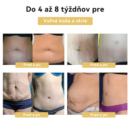 🧚🏻‍♂️𝑭𝑹𝑶𝑷𝑼𝑵™Včelí jed Zoštíhľujúci krém⭐(Pre všetky lymfatické problémy a obezitu)