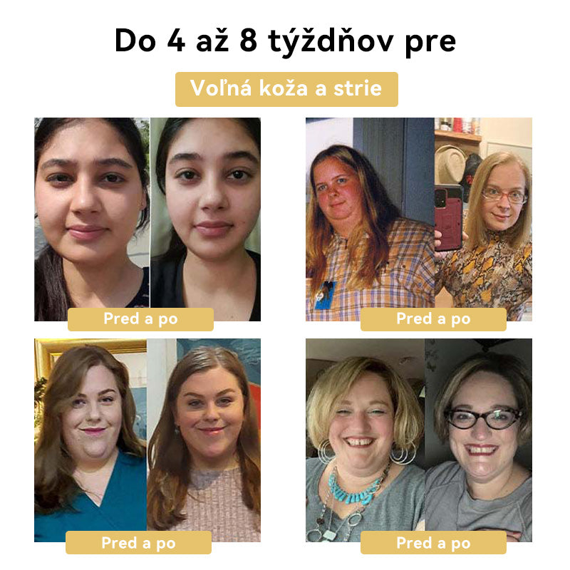 🧚🏻‍♂️𝑭𝑹𝑶𝑷𝑼𝑵™Včelí jed Zoštíhľujúci krém⭐(Pre všetky lymfatické problémy a obezitu)