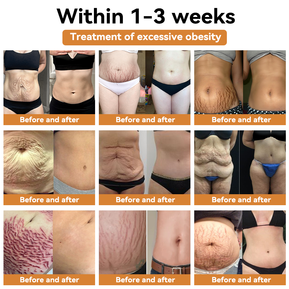 ⭐𝐋𝐚𝐬𝐭 𝐃𝐚𝐲 𝐃𝐢𝐬𝐜𝐨𝐮𝐧𝐭: 𝟕5% 𝐎𝐅𝐅⭐𝐕𝐎𝐂𝐉𝐅𝐄𝐈™ 𝐂𝐚𝐫𝐛𝐨𝐧 𝐍𝐚𝐧𝐨 𝐓𝐡𝐞𝐫𝐦𝐚𝐥-𝐒𝐞𝐧𝐬𝐢𝐧𝐠 𝐅𝐢𝐛𝐞𝐫 𝐈𝐨𝐧 𝐃𝐞𝐭𝐨𝐱 𝐒𝐡𝐚𝐩𝐢𝐧𝐠 𝐒𝐡𝐨𝐫𝐭𝐬