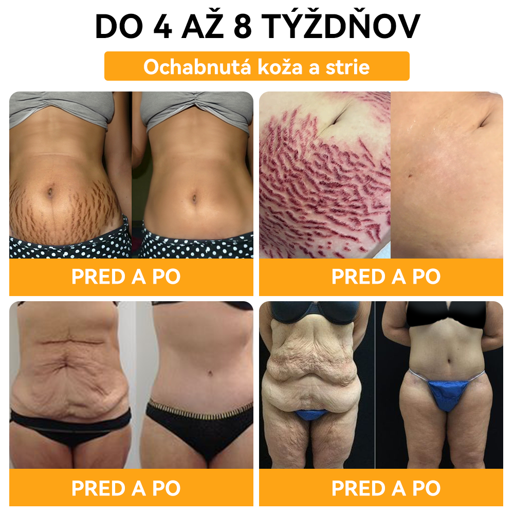 🌋𝐕𝐎𝐂𝐉𝐅𝐄𝐈™ 𝐕č𝐞𝐥í 𝐣𝐞𝐝 𝐥𝐨𝐧 𝐓𝐮𝐤 𝐒𝐩𝐚ľ𝐨𝐯𝐚𝐧𝐢𝐞 𝐃𝐞𝐭𝐨𝐱 𝐓𝐞𝐥𝐨 𝐒𝐡𝐚𝐩𝐞𝐫 Š𝐨𝐫𝐭𝐤𝐲⭐ [𝑷𝒐𝒔𝒍𝒆𝒅𝒏ý𝒄𝒉 20 𝒎𝒊𝒏ú𝒕, č𝒂𝒔𝒐𝒗𝒐 𝒐𝒃𝒎𝒆𝒅𝒛𝒆𝒏á 𝒛ľ𝒂𝒗𝒂: 𝟖𝟎% 𝐙Ľ𝐀𝐕𝐀]