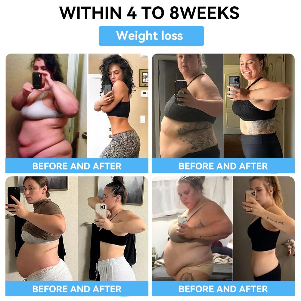 👑👑VOCJFEI™ Bee Venom lon Fat- Burning Detox Icy Silk Shapewear⭐ [Last 20 Minutes, Limited-Time Discount: 80% Off]