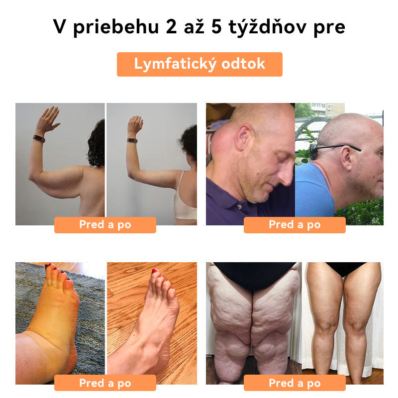 💧💧𝑭𝑹𝑶𝑷𝑼𝑵™ 𝑽č𝒆𝒍í𝒎 𝑱𝒆𝒅𝒐𝒎 𝑳𝒚𝒎𝒇𝒐𝒅𝒓𝒆𝒏áž𝒏𝒂 𝑵á𝒑𝒍𝒂𝒔ť 𝒏𝒂 𝑪𝒉𝒖𝒅𝒏𝒖𝒕𝒊𝒆⭐(𝒏𝒂 𝒗š𝒆𝒕𝒌𝒚 𝒍𝒚𝒎𝒇𝒂𝒕𝒊𝒄𝒌é 𝒑𝒓𝒐𝒃𝒍é𝒎𝒚 𝒂 𝒐𝒃𝒆𝒛𝒊𝒕𝒖)