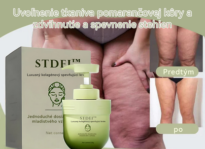 STDEI™ 💖 Luxusný kolagénový krém na pevnosť (návrat k mladistvej pleti)✨