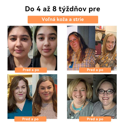 💧💧𝑭𝑹𝑶𝑷𝑼𝑵™ 𝑽č𝒆𝒍í𝒎 𝑱𝒆𝒅𝒐𝒎 𝑳𝒚𝒎𝒇𝒐𝒅𝒓𝒆𝒏áž𝒏𝒂 𝑵á𝒑𝒍𝒂𝒔ť 𝒏𝒂 𝑪𝒉𝒖𝒅𝒏𝒖𝒕𝒊𝒆⭐(𝒏𝒂 𝒗š𝒆𝒕𝒌𝒚 𝒍𝒚𝒎𝒇𝒂𝒕𝒊𝒄𝒌é 𝒑𝒓𝒐𝒃𝒍é𝒎𝒚 𝒂 𝒐𝒃𝒆𝒛𝒊𝒕𝒖)